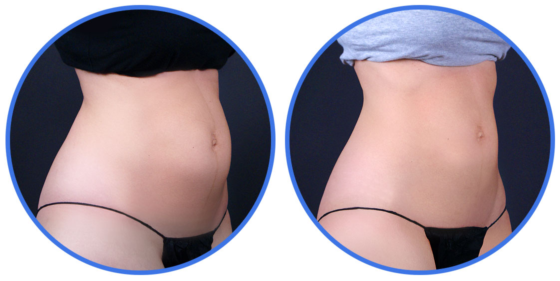 Dermatology Before and After Photos