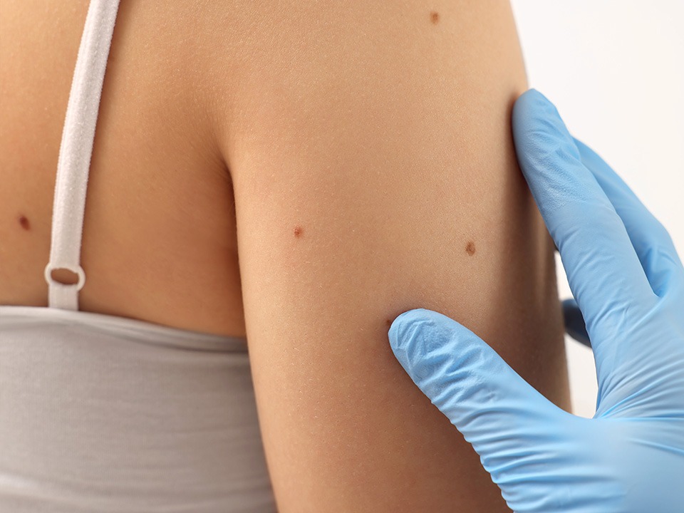 Dermatologist performing a skin examination for vitamin deficiency